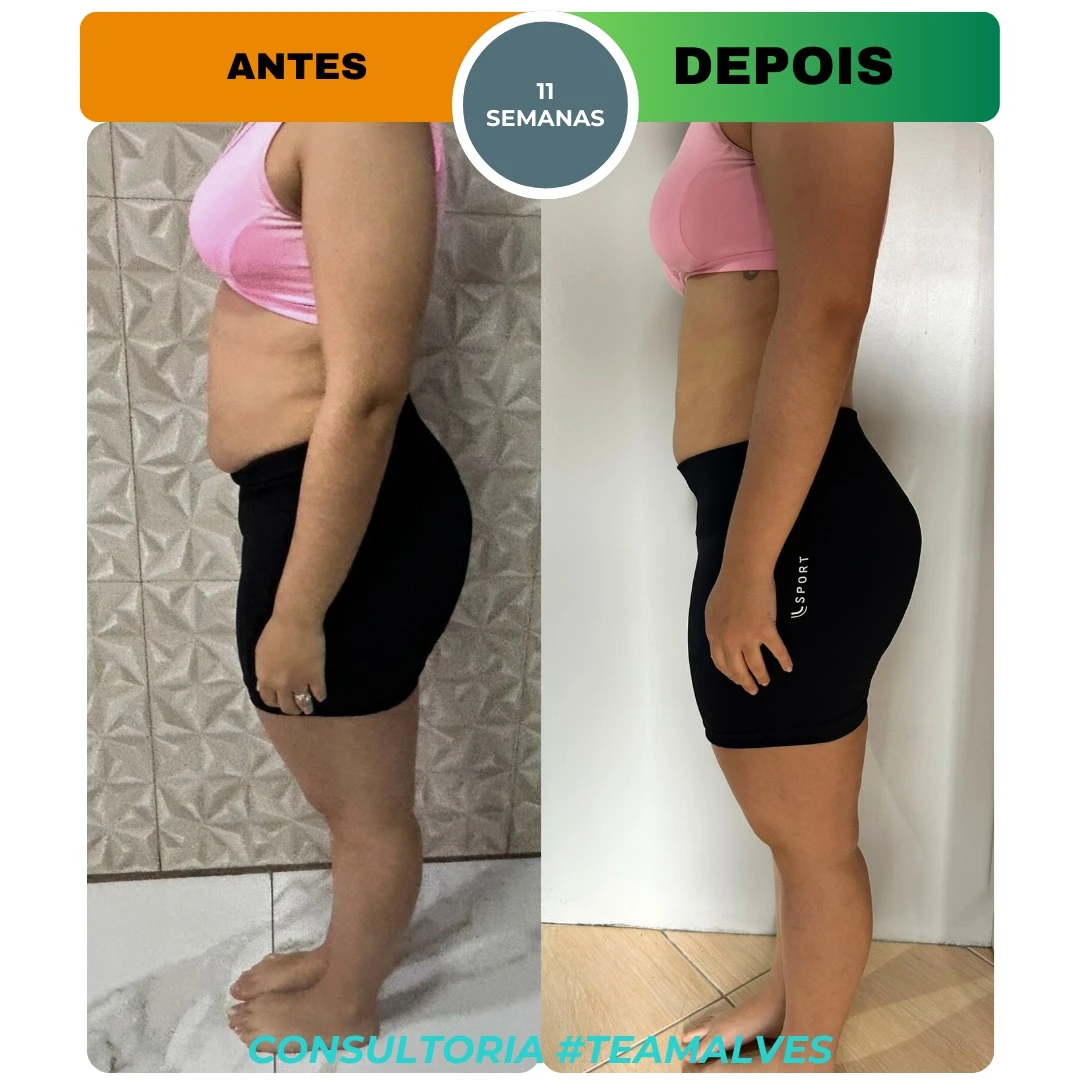 antes x depois 7